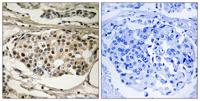 NFκB-p65 (phospho Ser281) Polyclonal Antibody