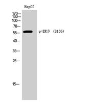 ERβ (phospho Ser105) Polyclonal Antibody