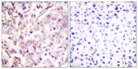 Ets-1 (phospho Thr38) Polyclonal Antibody