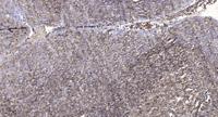 Ezrin (phospho Tyr478) Polyclonal Antibody