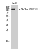 FGF Receptor 1/2 (phospho Tyr463/466) Polyclonal Antibody