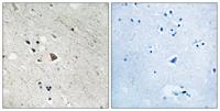 Flt-3 (phospho Tyr969) Polyclonal Antibody