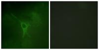 GFAP (phospho Ser38) Polyclonal Antibody