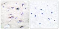 GluR-2 (phospho Ser880) Polyclonal Antibody