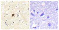 GluR4 (phospho Ser862) Polyclonal Antibody