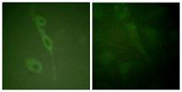 IL-7R (phospho Tyr449) Polyclonal Antibody