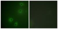Integrin β1 (phospho Thr789) Polyclonal Antibody