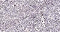 Intestinal Cell Kinase (phospho Tyr159) Polyclonal Antibody