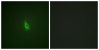IP3R-I (phospho Ser1598) Polyclonal Antibody