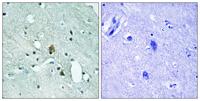 IP3R-I (phospho Ser1764) Polyclonal Antibody