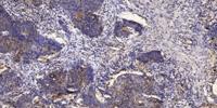 IRF-3 (phospho Ser386) Polyclonal Antibody