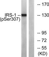 IRS-1 (phospho Ser307) Polyclonal Antibody