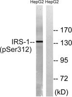 IRS-1 (phospho Ser312) Polyclonal Antibody