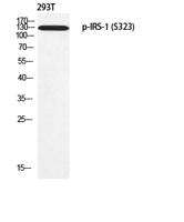 IRS-1 (phospho Ser323) Polyclonal Antibody