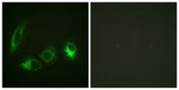 IRS-1 (phospho Ser323) Polyclonal Antibody