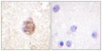 IRS-1 (phospho Ser794) Polyclonal Antibody