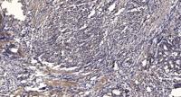 IRS-1 (phospho Tyr896) Polyclonal Antibody