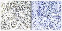 IκB-α (phospho Tyr305) Polyclonal Antibody