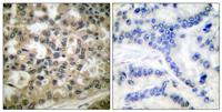 IκB-β (phospho Ser23) Polyclonal Antibody
