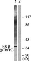 IκB-β (phospho Thr19) Polyclonal Antibody