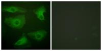 IκB-ε (phospho Ser22) Polyclonal Antibody