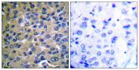 IκB-ε (phospho Ser22) Polyclonal Antibody