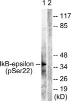IκB-ε (phospho Ser22) Polyclonal Antibody