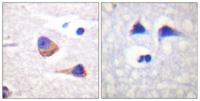 JAK3 (phospho Tyr785) Polyclonal Antibody