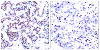 Jun B (phospho Ser259) Polyclonal Antibody