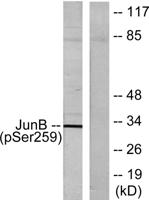 Jun B (phospho Ser259) Polyclonal Antibody