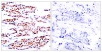 Jun B (phospho Ser79) Polyclonal Antibody