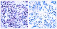 Jun D (phospho Ser255) Polyclonal Antibody