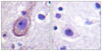 KCNQ2/3/4/5 (phospho Thr217/246/223/251) Polyclonal Antibody