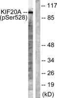 KIF20A (phospho Ser528) Polyclonal Antibody
