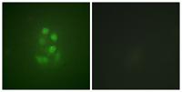 KIF2C (phospho Ser95) Polyclonal Antibody