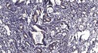 KIF2C (phospho Ser95) Polyclonal Antibody