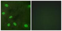 KIR3.1 (phospho Ser185) Polyclonal Antibody