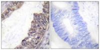KIR3.1 (phospho Ser185) Polyclonal Antibody
