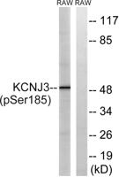 KIR3.1 (phospho Ser185) Polyclonal Antibody