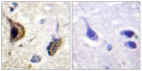 KIR5.1 (phospho Ser416) Polyclonal Antibody