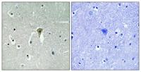 KIR6.2 (phospho Thr224) Polyclonal Antibody