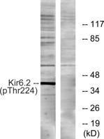 KIR6.2 (phospho Thr224) Polyclonal Antibody