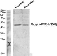 KOR-1 (phospho Ser369) Polyclonal Antibody