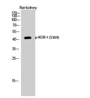 KOR-1 (phospho Ser369) Polyclonal Antibody