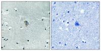 KOR-1 (phospho Ser369) Polyclonal Antibody