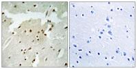 Ku-70 (phospho Ser5) Polyclonal Antibody