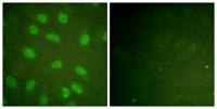Ku-80 (phospho Thr714) Polyclonal Antibody