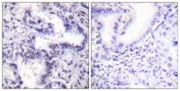 Ku-80 (phospho Thr714) Polyclonal Antibody