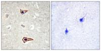 Kv1.3 (phospho Tyr187) Polyclonal Antibody