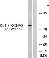 Kv1.3 (phospho Tyr187) Polyclonal Antibody